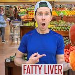 Top 10 Foods For Reversing FATTY LIVER DISEASE…A…