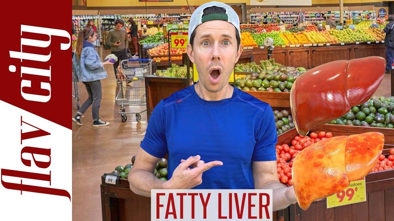 Top 10 Foods For Reversing FATTY LIVER DISEASE…A…